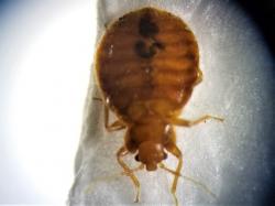 Image of a Bed Bug Under a Microscope